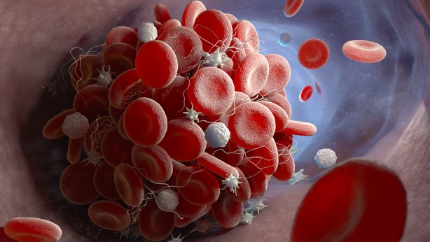 Understand the Reason Behind the Blood Clotting
